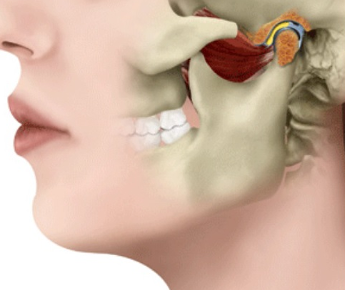 DOR-NA-ARTICULACAO-DA-BOCA-e1502118119561